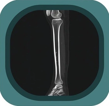 CT lower leg anatomy icon